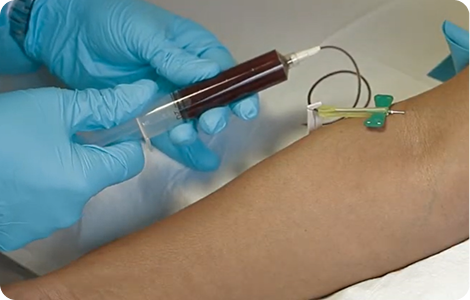 Photo of a whole blood draw from a patient's arm