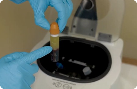 Photo of loading the PRP concentrating tube into the centrifuge