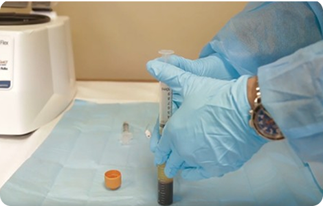 Photo of collecting the concentrated PRP from the tube